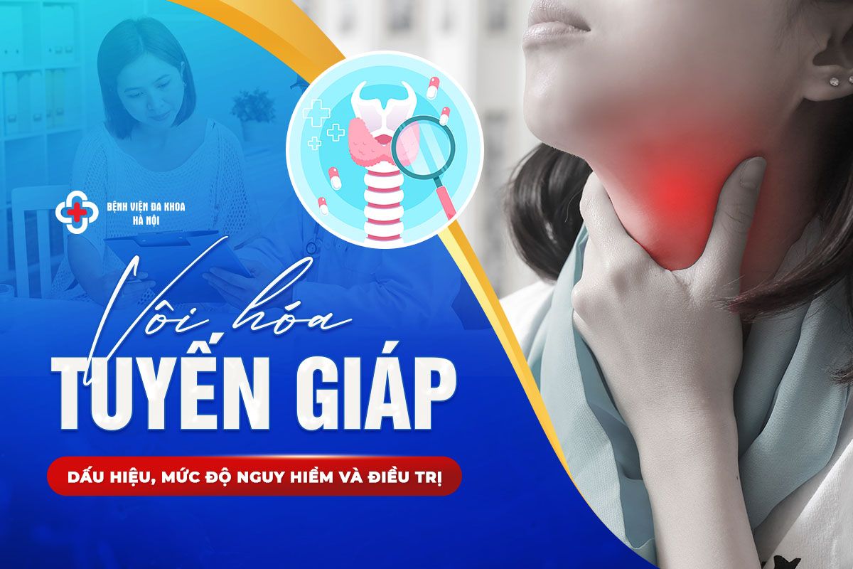 Vôi Hóa Tuyến Giáp: Dấu Hiệu, Mức Độ Nguy Hiểm Và Điều Trị