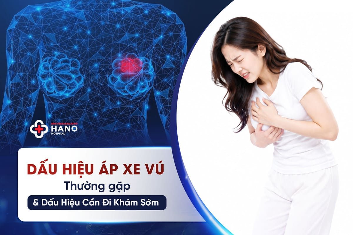 Dấu Hiệu Áp Xe Vú Thường Gặp & 3 Biểu Hiện Cần Đi Khám Sớm