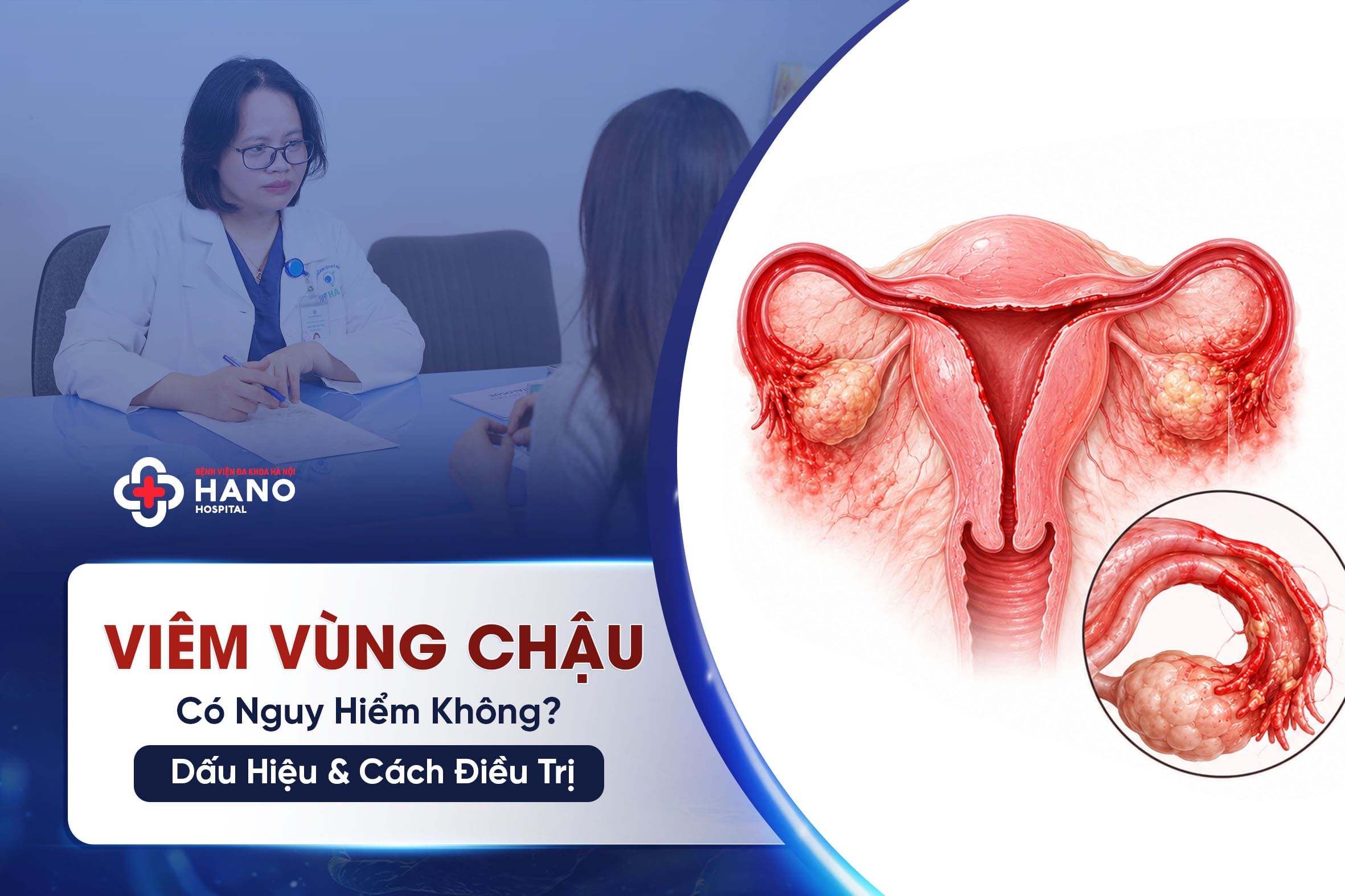 Viêm Vùng Chậu Có Nguy Hiểm Không? Dấu Hiệu & Cách Điều Trị