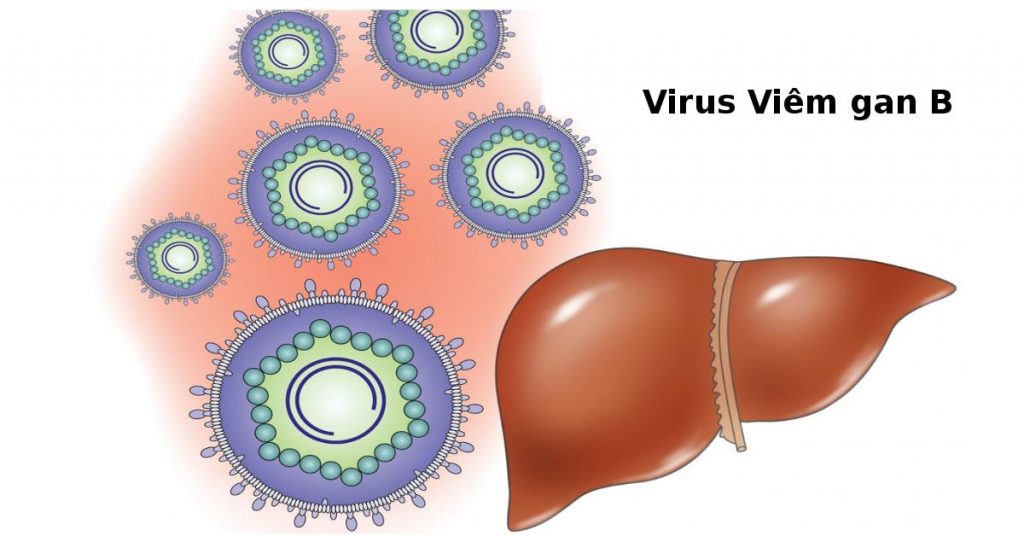 Viêm Gan Siêu Vi B: Nguyên Nhân, Triệu Chứng Và Cách Phòng Bệnh - Bệnh ...