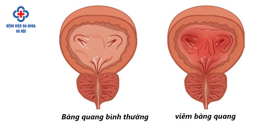 Tầm Quan Trọng của Việc Thăm Khám Định Kỳ