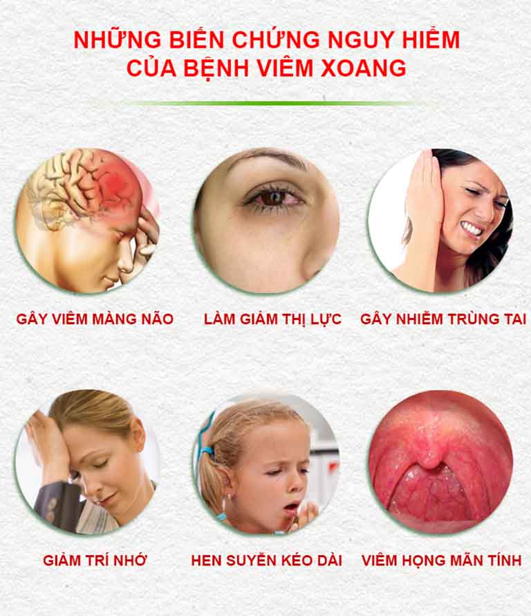 NỘI SOI MŨI XOANG - Bệnh viện đa khoa Hà Nội