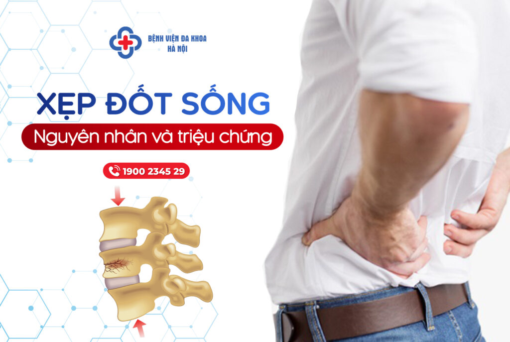 xẹp đốt sống