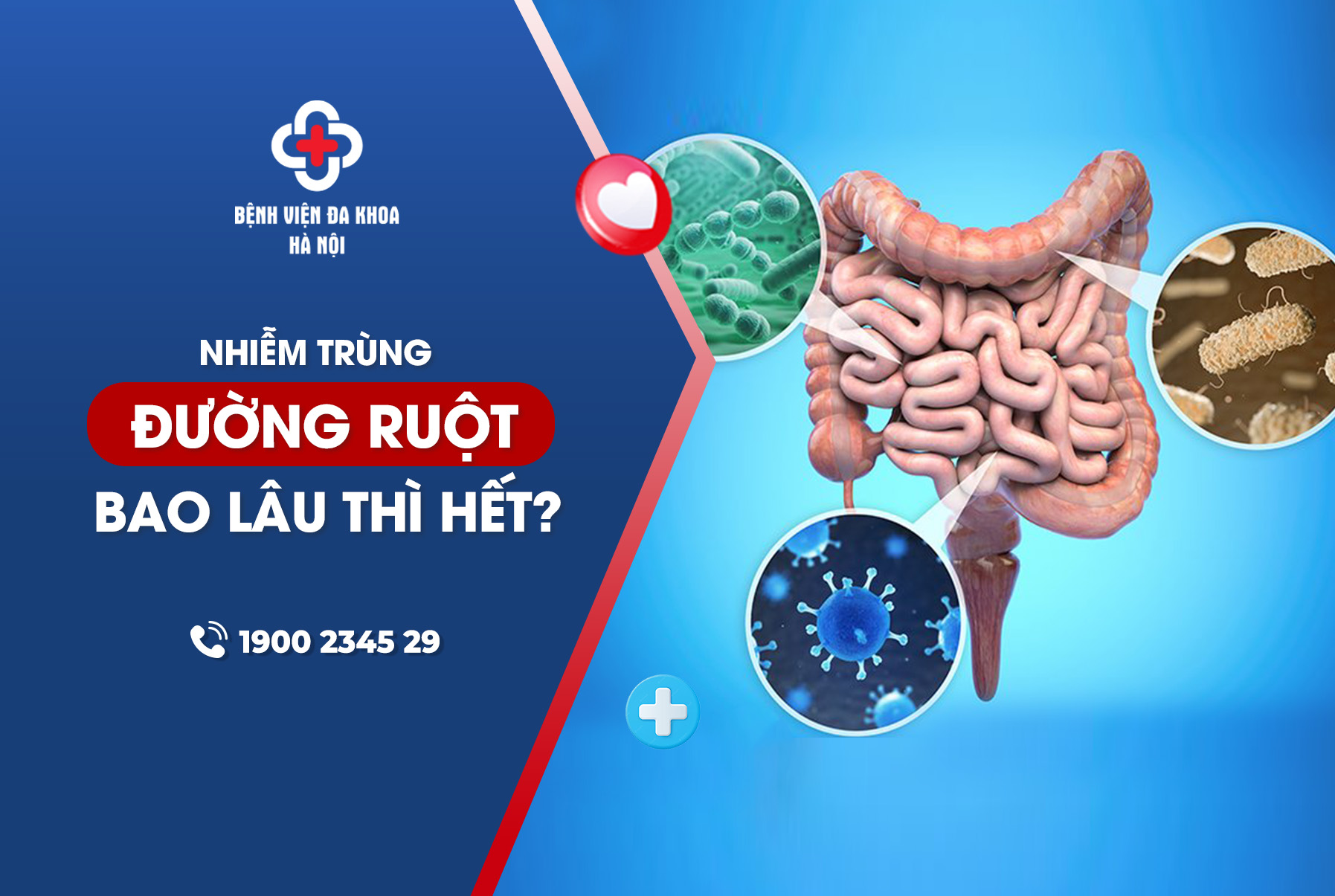 Phương pháp điều trị nhiễm trùng đường ruột