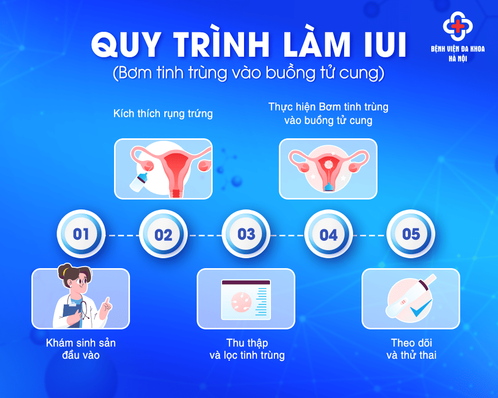 IUI (Bơm tinh trùng vào buồng tử cung)

