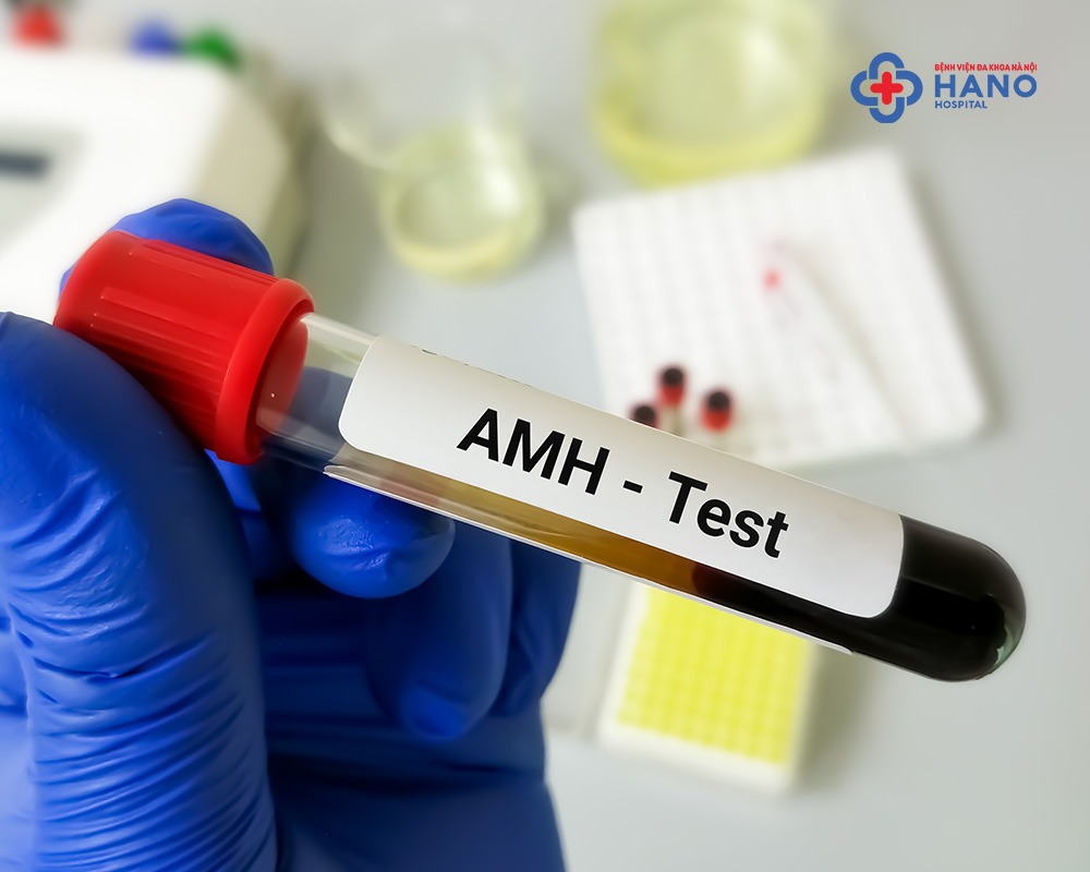 Khái niệm xét nghiệm AMH
