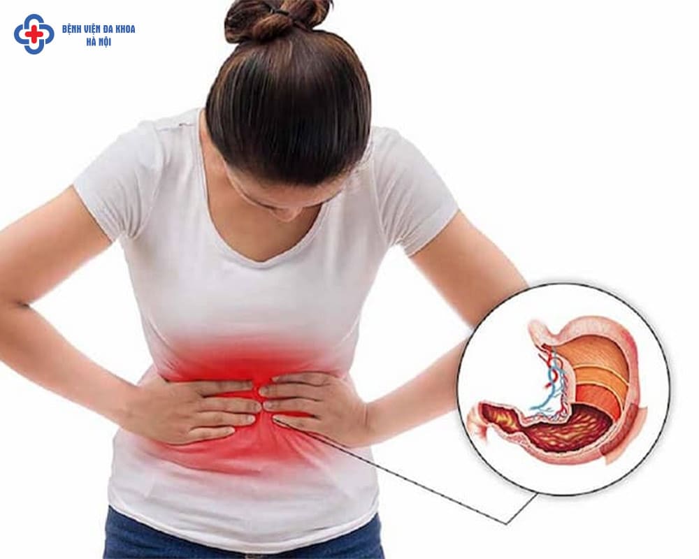 Cơn đau bụng trên rốn là dấu hiệu cảnh báo nhiều vấn đề sức khỏe khác nhau