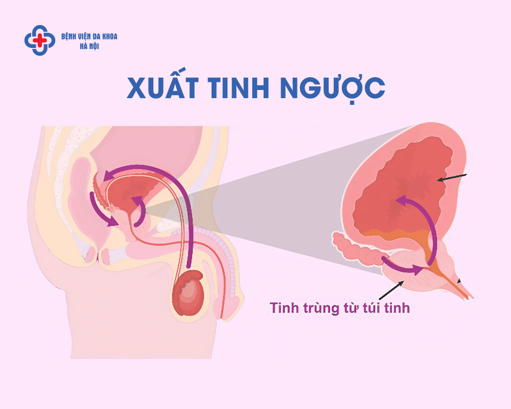 Ảnh minh hoạ xuất tinh ngược