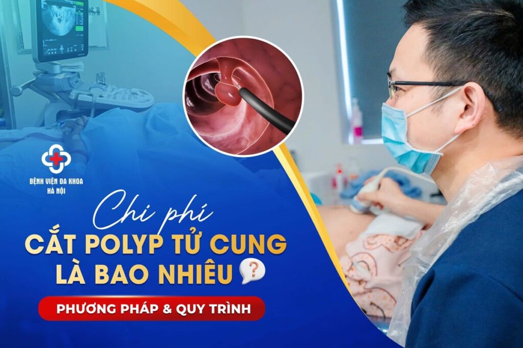 BẢNG GIÁ CẮT POLYP TỬ CUNG Ở BỆNH VIỆN PHỤ SẢN HÀ NỘI