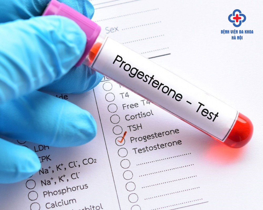Theo dõi chỉ số progesterone
