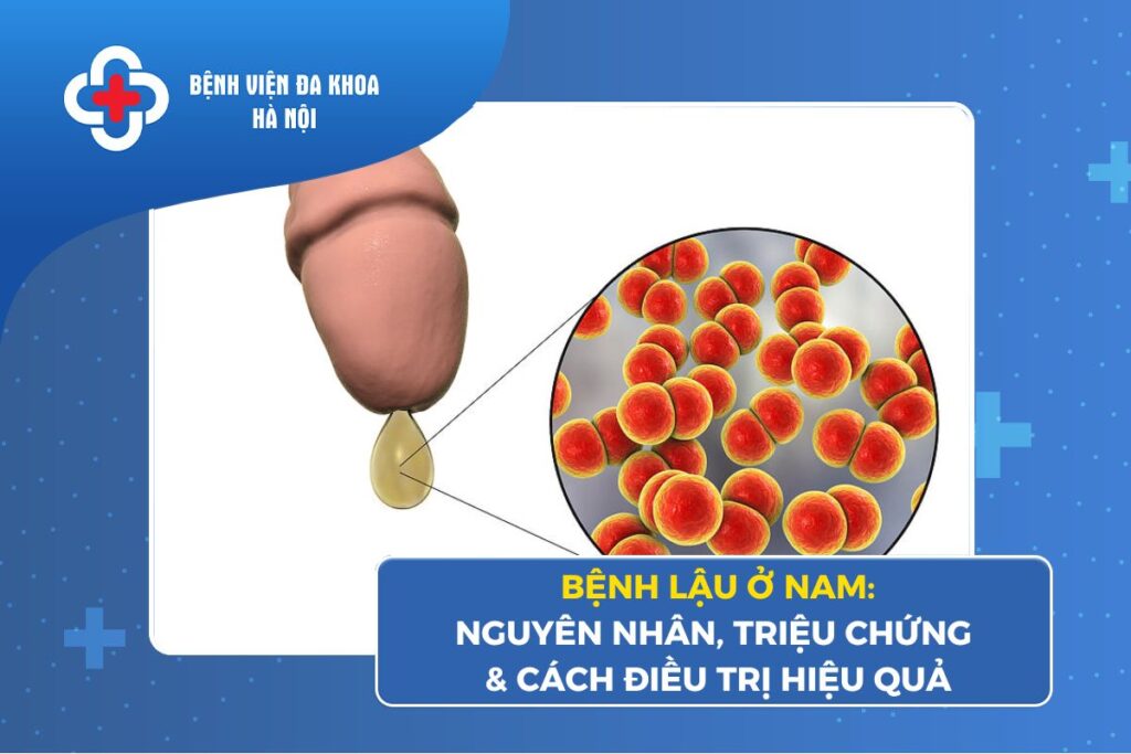 Bệnh Lậu Ở Nam: Nguyên Nhân, Triệu Chứng & Cách Điều Trị Hiệu Quả