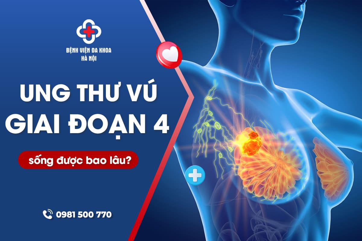 UNG THƯ PHỔI GIAI ĐOẠN 4 DI CĂN HẠCH XUẤT HIỆN SƯNG VÙNG CỔ HOẶC NGỰC