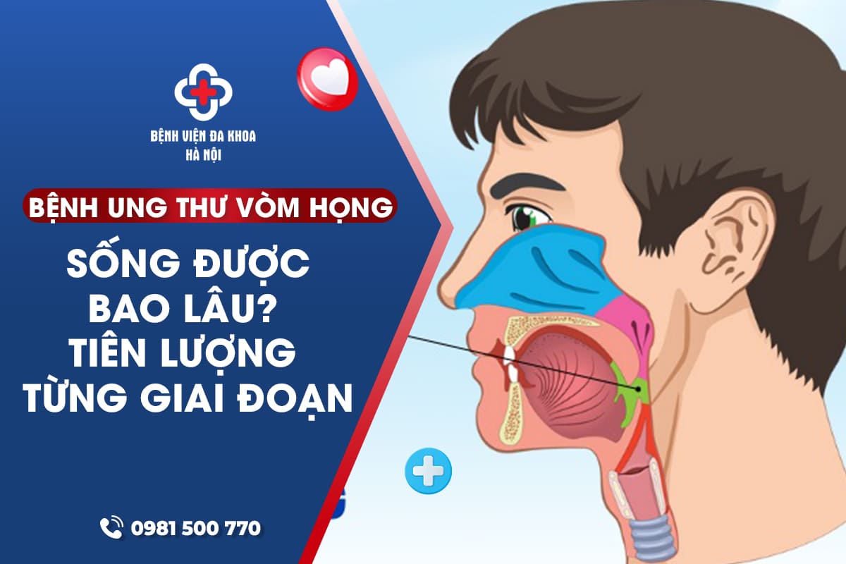 TÌNH TRẠNG UNG THƯ VÒM HỌNG GIAI ĐOẠN 3 VỚI TỔN THƯƠNG MỞ RỘNG