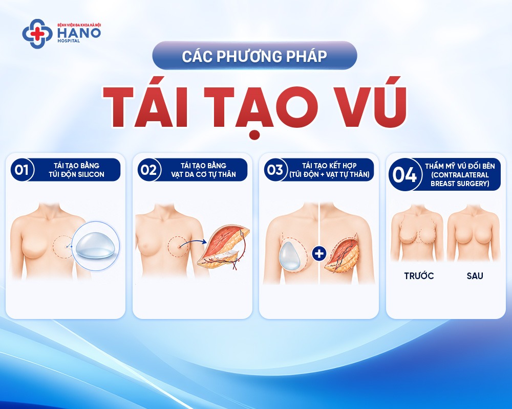 Các phương pháp tái tạo vú