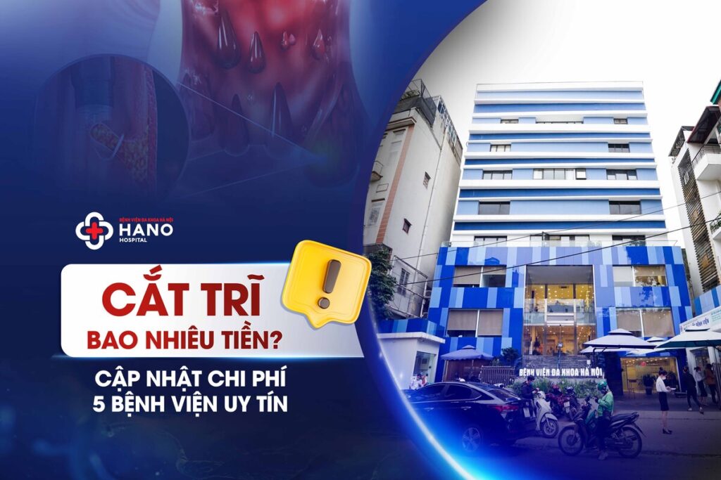 Cập Nhật Chi Phí Cắt Trĩ Tại 5 Bệnh Viện Uy Tín