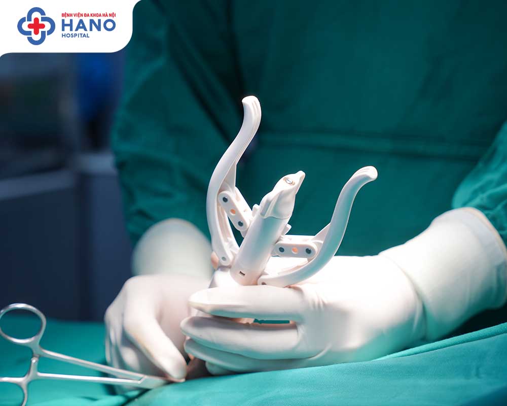 Cắt bao quy đầu bằng máy stapler