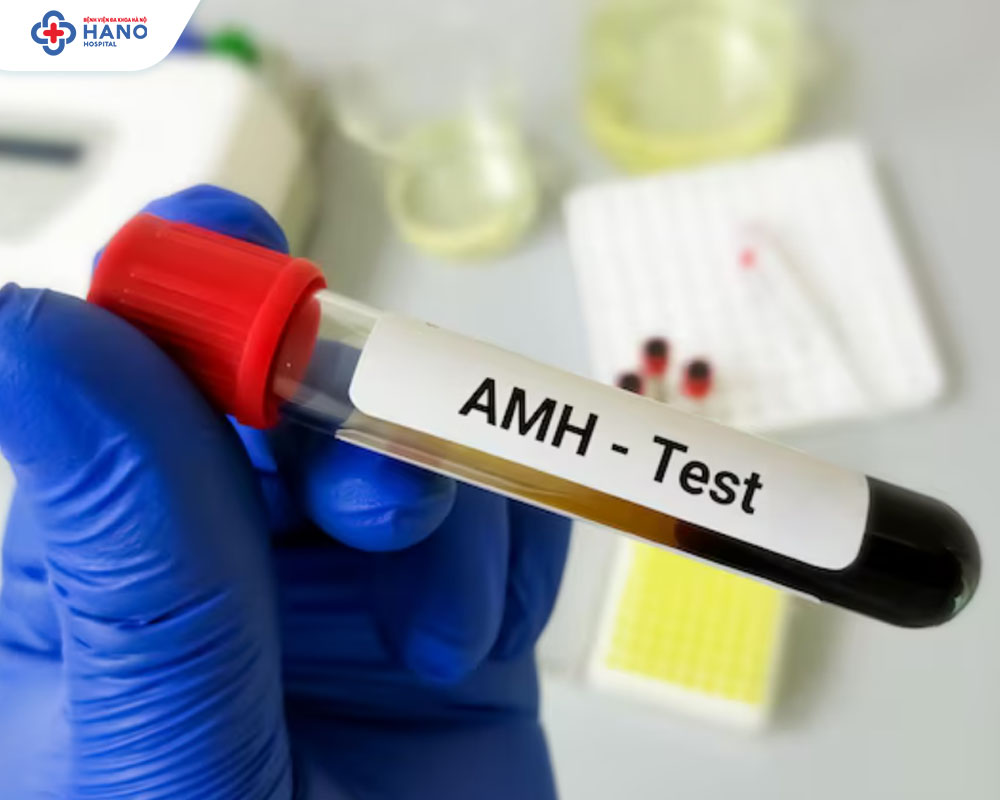 AMH thấp có phải suy buồng trứng sớm không?
