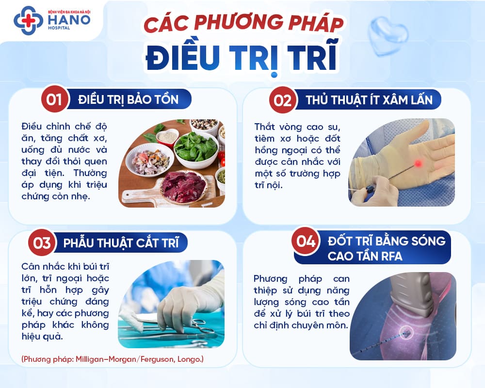 Tổng hợp các phương pháp điều trị trĩ
