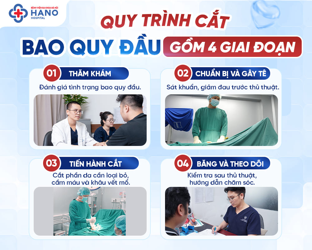 Quy trình cắt bao quy đầu gồm những bước nào?