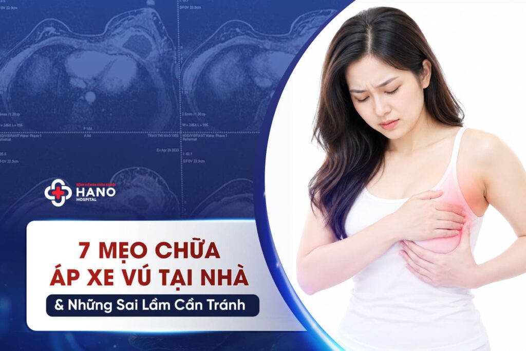 7 Mẹo Chữa Áp Xe Vú Tại Nhà & Những Sai Lầm Cần Tránh