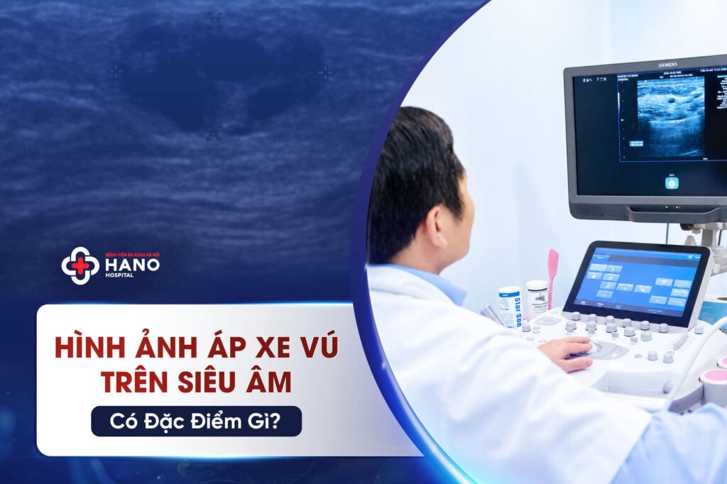Hình Ảnh Áp Xe Vú Trên Siêu Âm Có Đặc Điểm Gì?